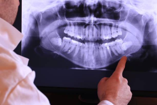 Best Emergency Denture Repair in Dry Ridge, KY